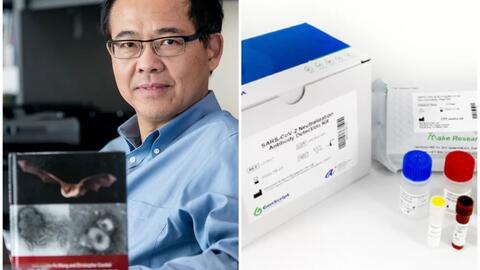 Thông tin bộ xét nghiệm kháng thể chống Covid-19