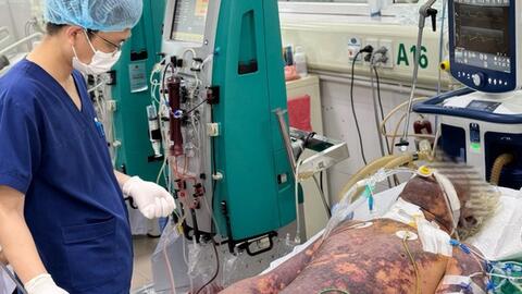 Mổ thịt lợn, người đàn ông mắc liên cầu lợn nguy kịch